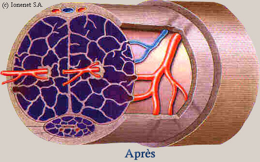 Cavits des corps caverneux dans leur dimensions initiales, aprs plusieurs mois d'entranement