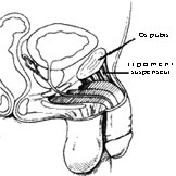 Le ligament suspenseur plus dans le dtail